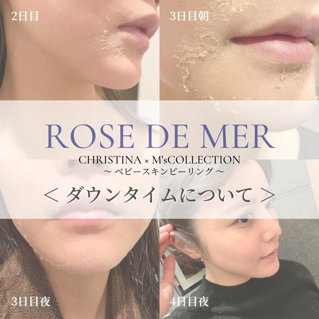 ローズドメーラ・ダウンタイムについて