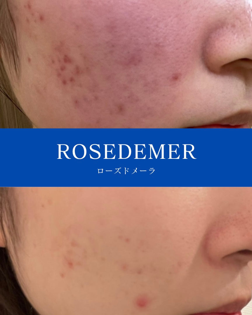 ローズドメーラ